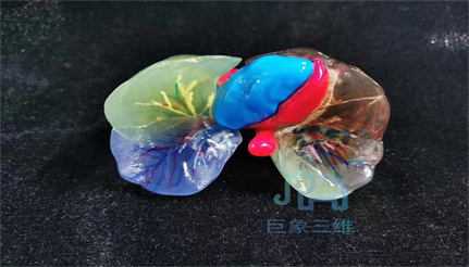 術前規(guī)劃3D打印